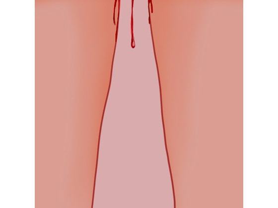 生理痛に呻く真園あきら