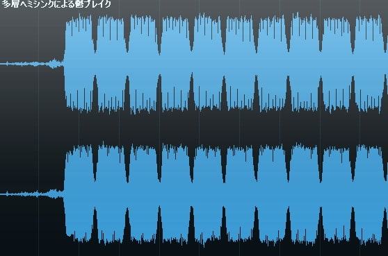 多層ヘミシンクによる鬱ブレイク