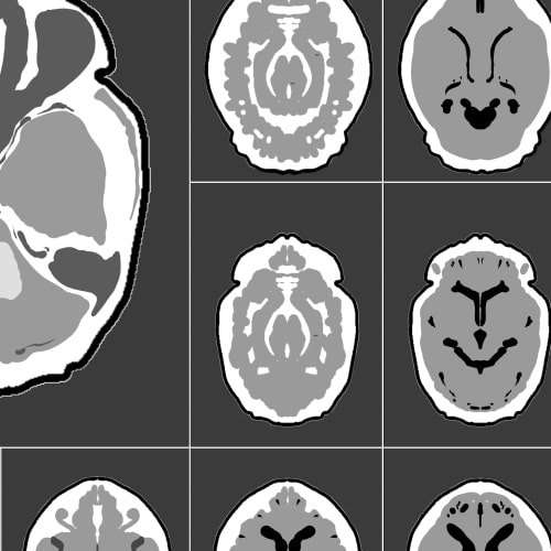 素材をどうぞ『MRI脳画像』
