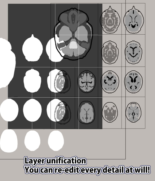 素材をどうぞ『MRI脳画像』