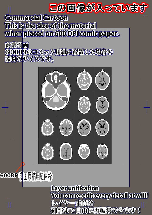 素材をどうぞ『MRI脳画像』