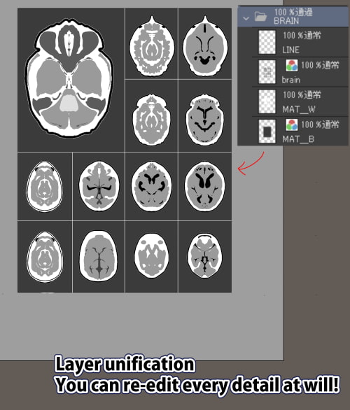 素材をどうぞ『MRI脳画像』