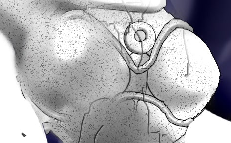 SHADOW LA○Y シャドウレ○ィ外伝 〜スパークガール 危機一髪!!