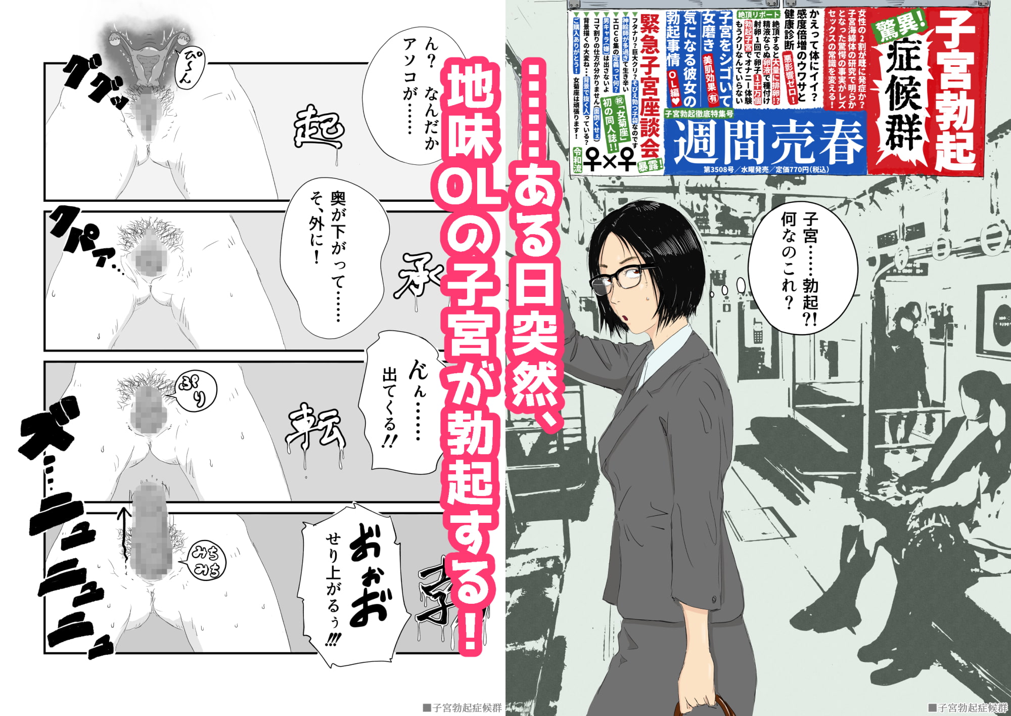 子宮勃起症候群