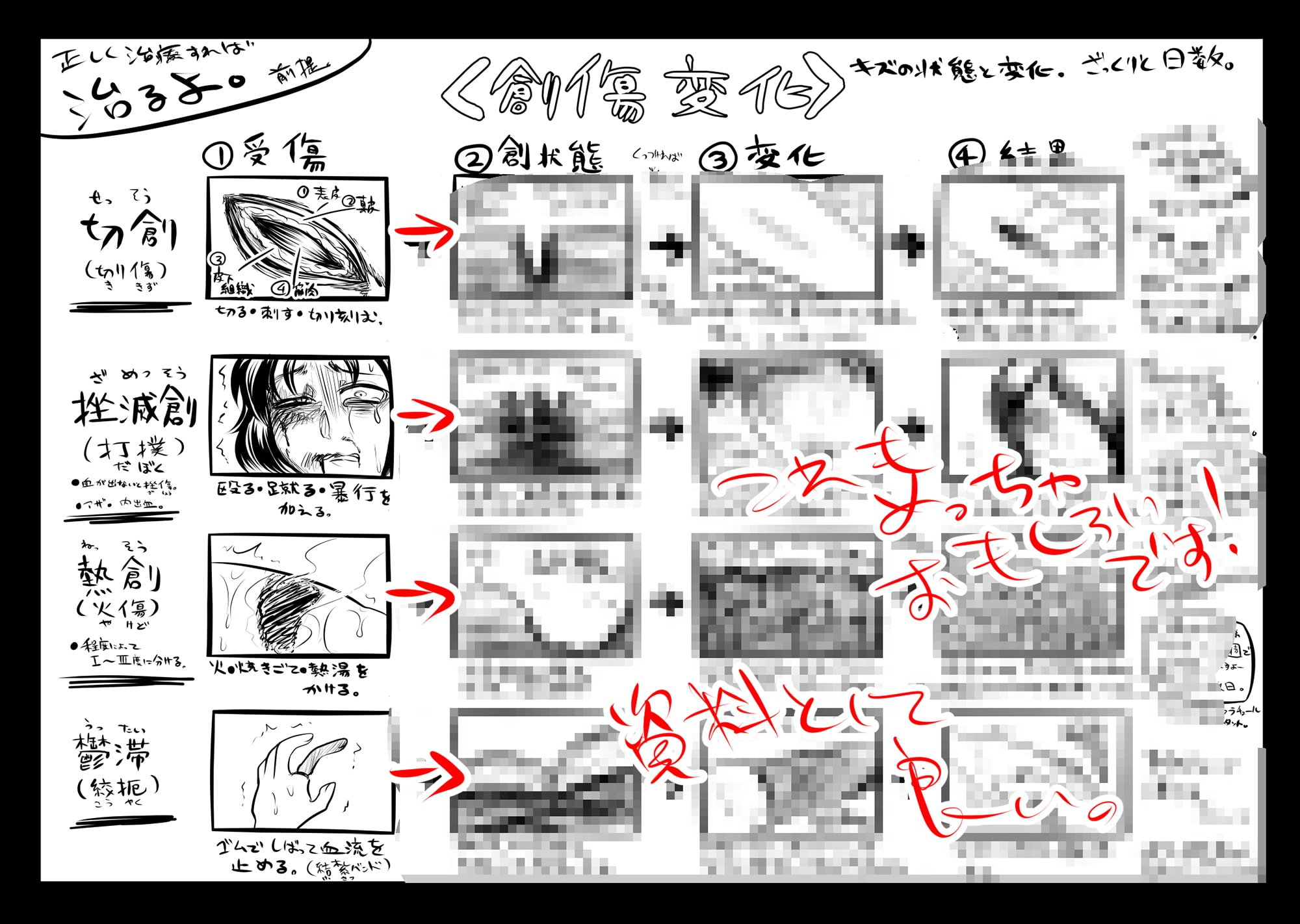 リョナラーの為の解剖生理!