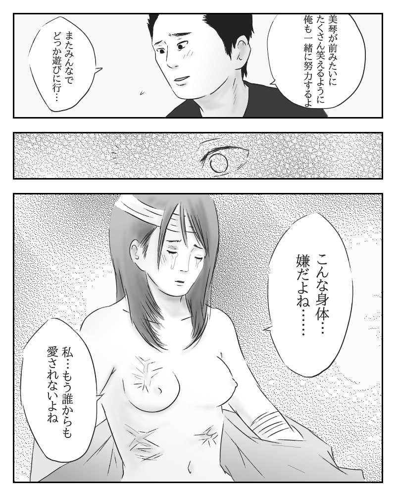 愛と真心と火傷