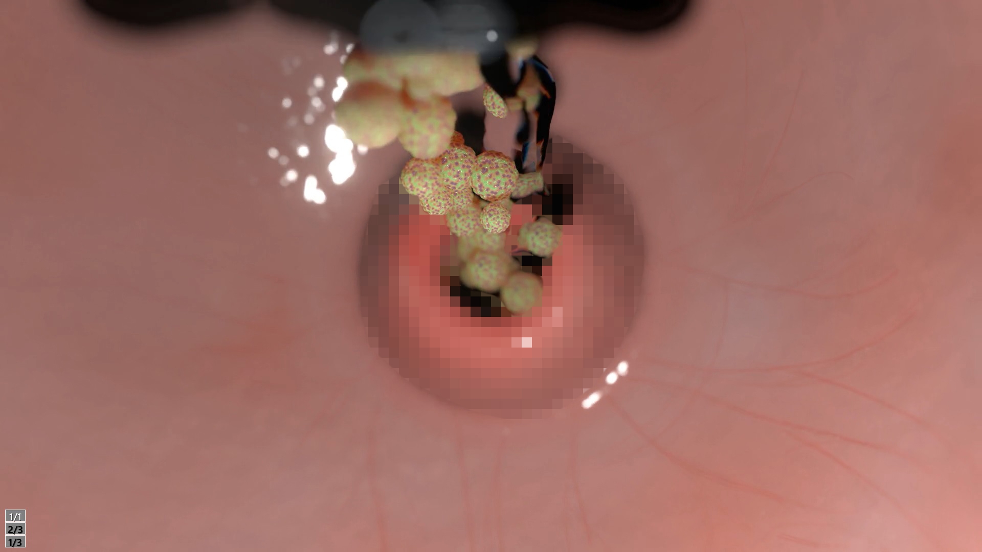 囚われた眼鏡っ子JK