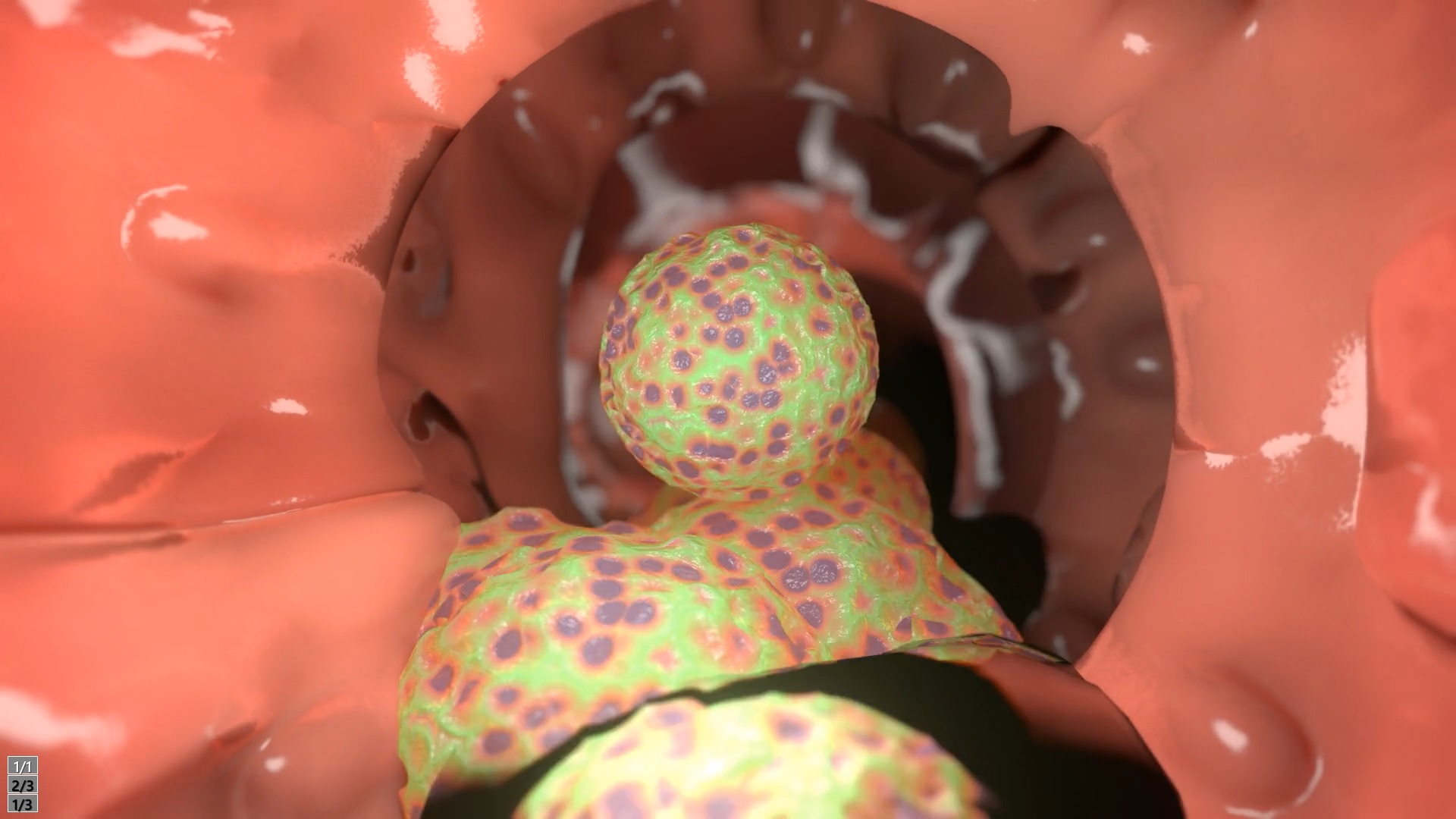 囚われた眼鏡っ子JK