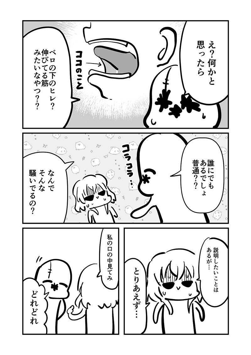 ベロをレーザーで焼いた話1