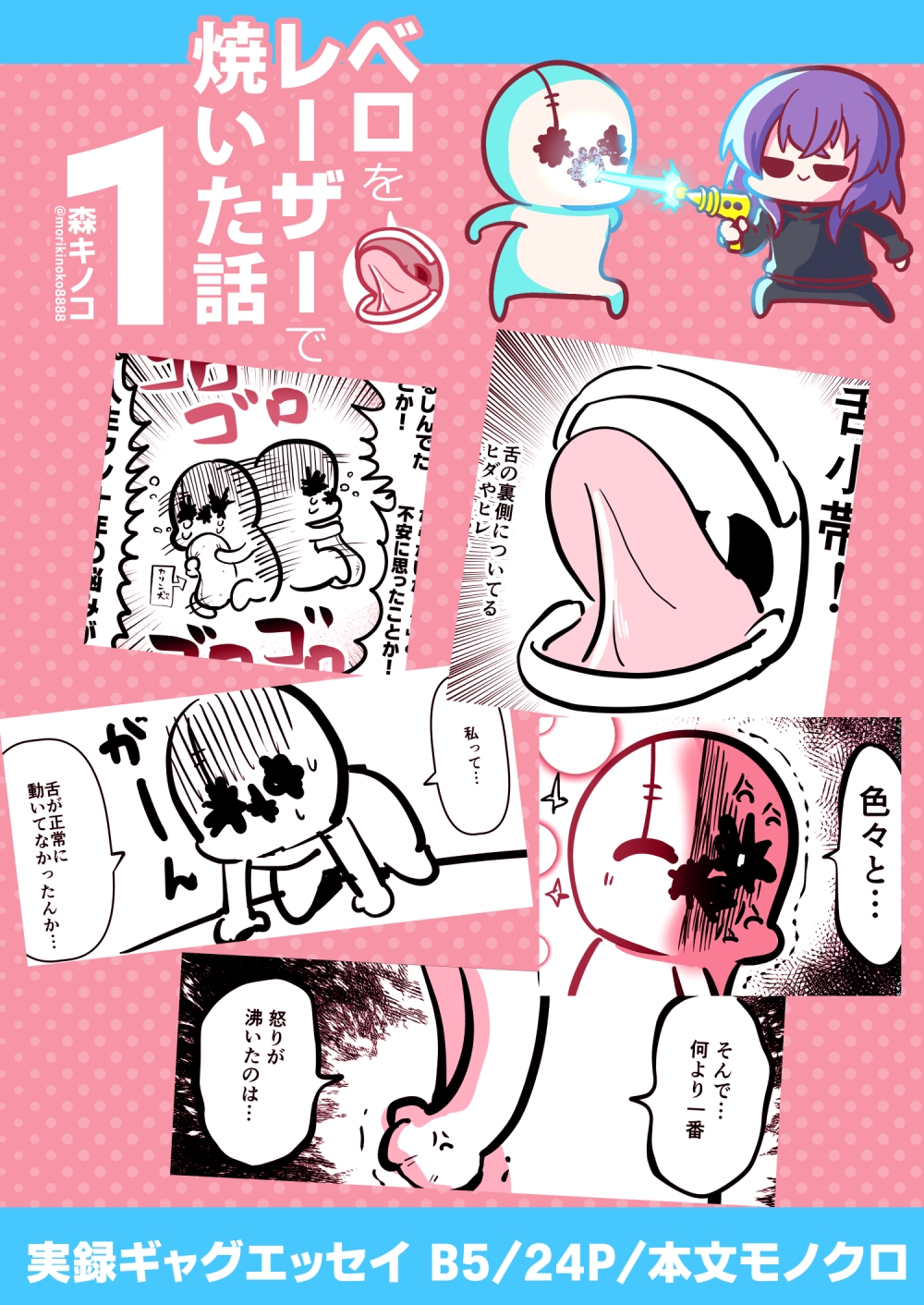 ベロをレーザーで焼いた話1