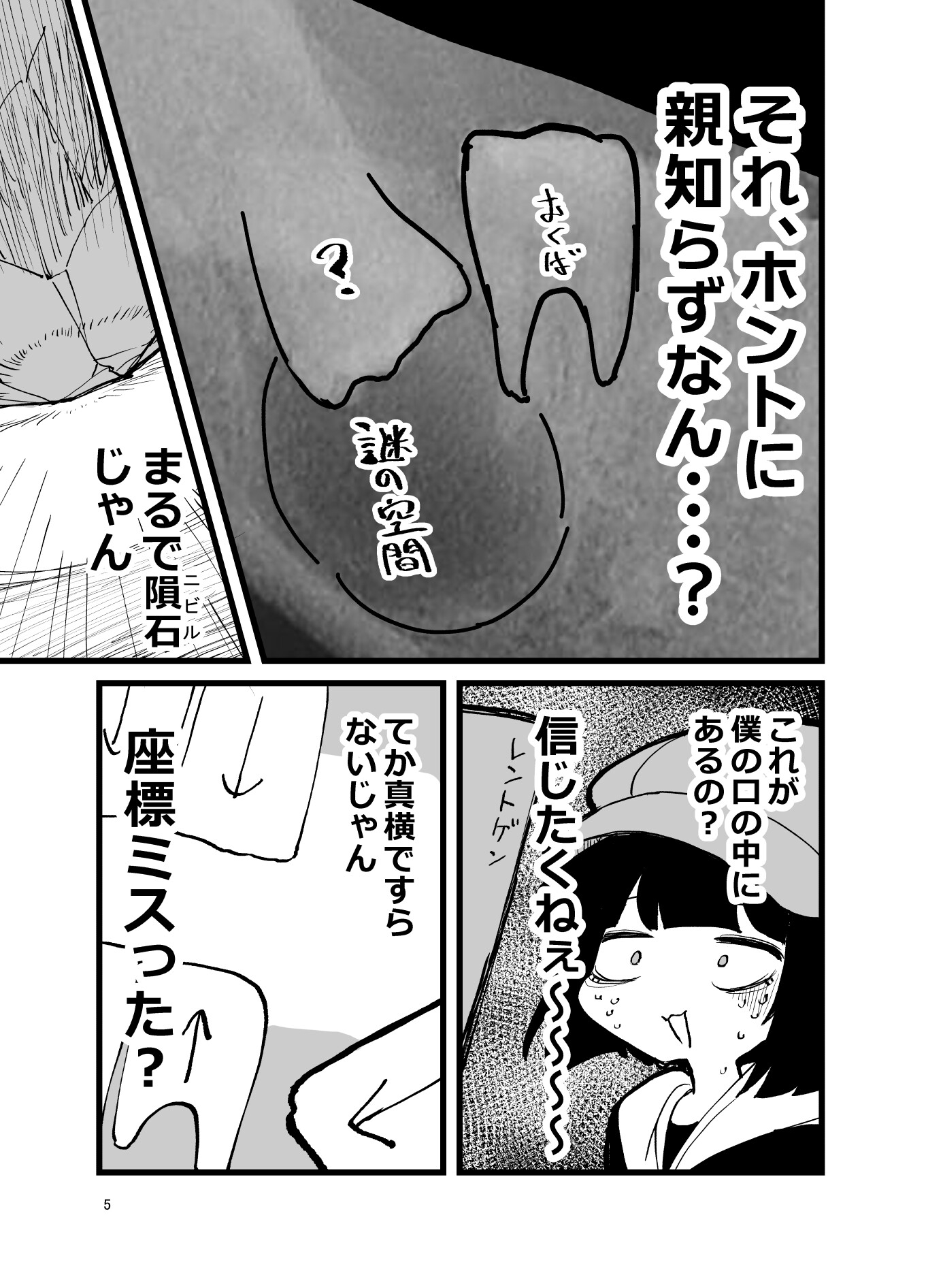[実録]ふんぼの親知らずがありえん向きで 生えたせいで全身麻酔手術した話