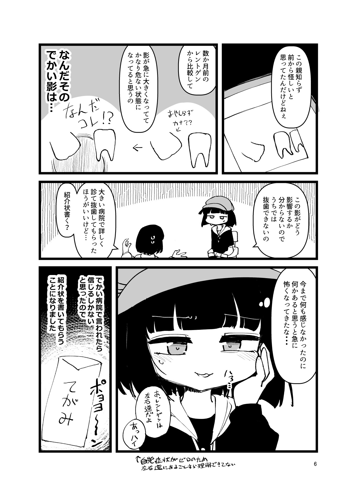 [実録]ふんぼの親知らずがありえん向きで 生えたせいで全身麻酔手術した話