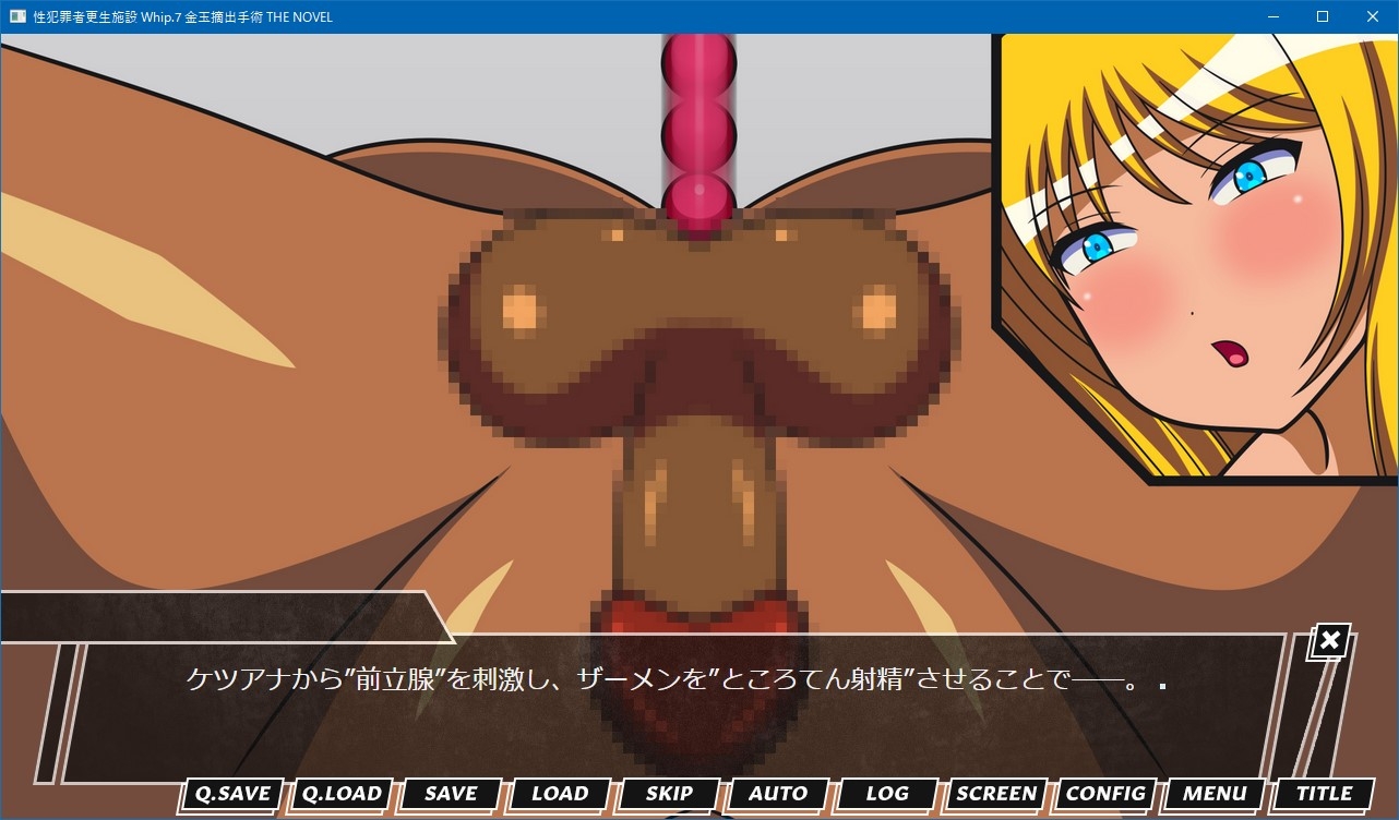 性犯罪者更生施設 Whip.7 金玉摘出手術 THE NOVEL