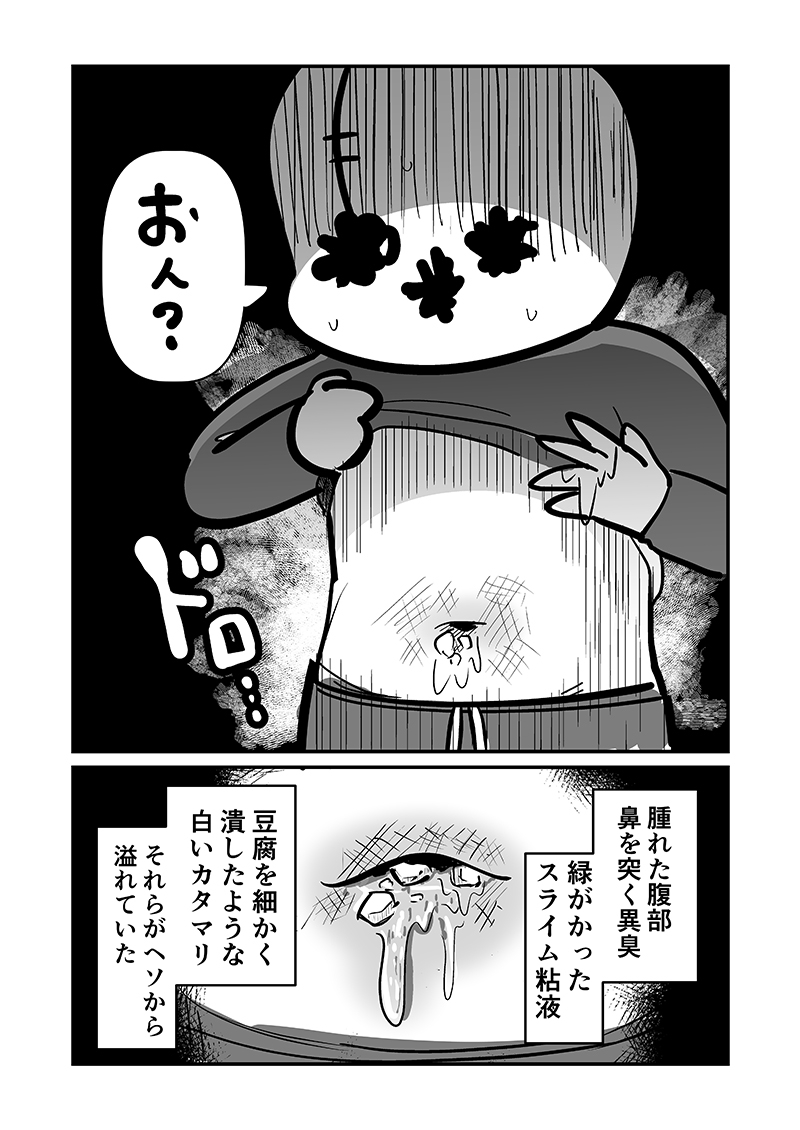 〆切に追われて栄養剤+仮眠を繰り返していたらおヘソから膿が出て入院した話2 – Preview 6